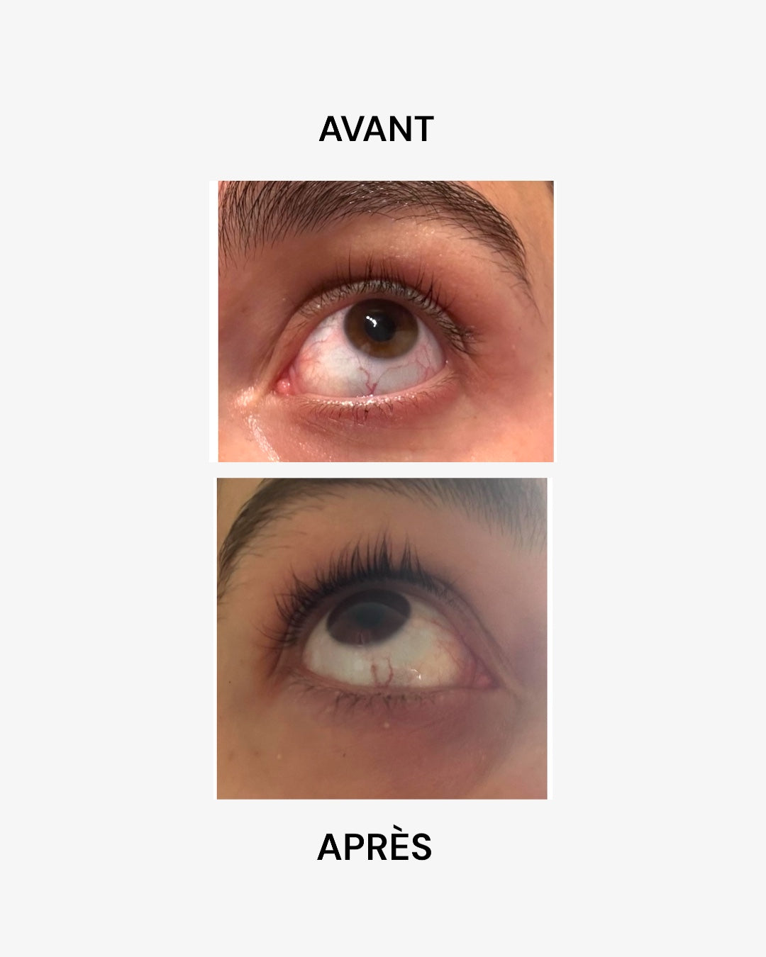 SÉRUM DE CROISSANCE POUR CILS